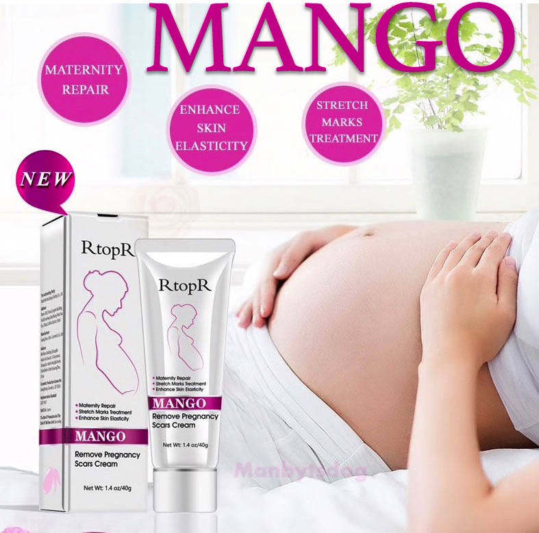 cream for post pregnancy stretch marks